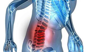 Lumbar Osteochondrosis- ի նշաններ եւ ախտանիշներ